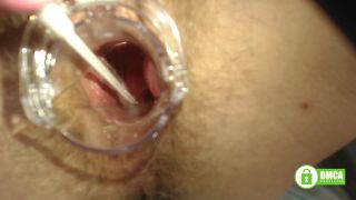 PregnantMiodelka Painful gyno exam Gaping hairy pussy wi - Doctor-8