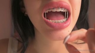 Ruth LeeBraces & Spit Fetish-5