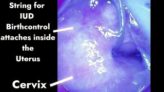 Stella St Rose - Camera Goes Inside of My Pussy with Cervix Views-9
