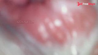 Creamy Cervix-0