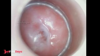 Creamy Cervix-9