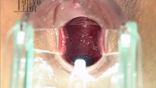 6204 Akane Midorikawa 1-6