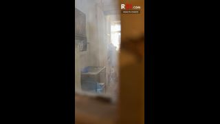 R51 7 - Day 2 - Anal examination.-2