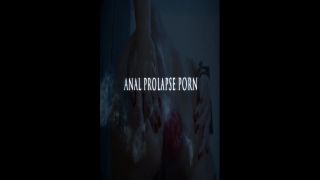 online adult clip 9 hairy anal fisting / fisting / mature porn-0