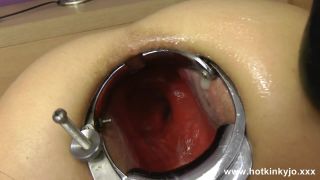 free xxx video 46 XO speculum and long dildo fuck - 09.04.2017 [HD 248.4 MB], asian girl fisting on fetish porn -5