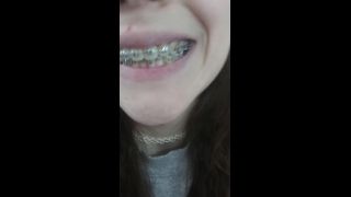 online porn clip 21 Braces tour – LilRedVelvet on fetish porn -8