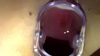 Amateur Spreading my pussy open with a speculum and filling it with fake cum until its full-1