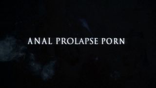 New 2021 Unique Pov Fisting With Crazy Couple Teresaf Dow...-9
