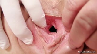 Terra Sweet Gyno Exam-1