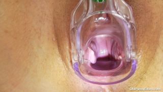 Old Pussy Exam - Drahuse - Pussy closeups-5