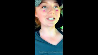 HayleeLove () Hayleelove - i thought this might give you guys a giggle heres me after the dentist yesterday 20-06-2020-3