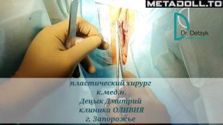 Metadoll.to - Gynecological medical films 45-7