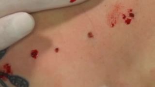 free video 24 Body suspensions - fetish - asian girl porn asian interracial porn-9