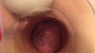 Denni Real Extreme Videos #15: Coral Fisted, Fucked, & Creampied - Fisting,large insertions,gaping,speculum play,allsex-3