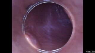 RAW endoscopic video-5