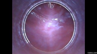 RAW endoscopic video-7