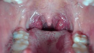 M@nyV1ds - mia_isabella3 - Braces, mouth, uvula fetish-4