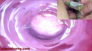 Cervix insertion - Peehole play urethral sounding endosc...-4