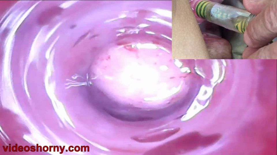 Cervix insertion - Peehole play urethral sounding endosc...