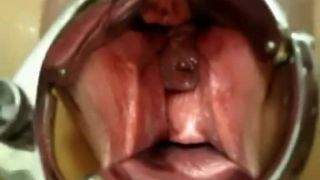 online porn clip 17 Monster pussy stuffing | fisting | fetish porn augustine femdom-2