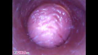 RAW Endoscopic Video Fisting-5