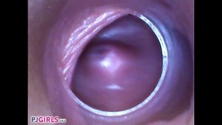 video 38 RAW Endoscopic Video | gyno | brunette girls porn blonde sex porn-7