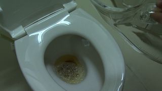 Psychiatry dream asia teen into a sex horror dream chines...-1