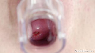 ClinicFetishMedicalVideo00164-9