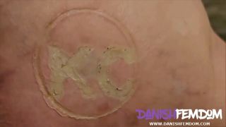 burnmarked and whippped.-0