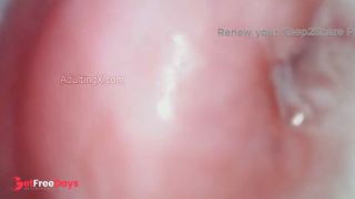 Watch my Cervix while I Masturbate-1