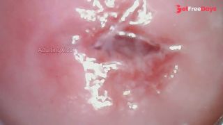 Watch my Cervix while I Masturbate-3