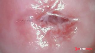 Watch my Cervix while I Masturbate-4