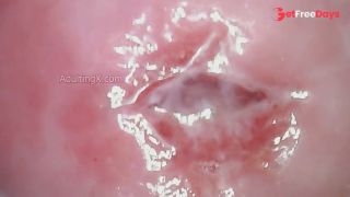 Watch my Cervix while I Masturbate-5
