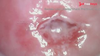 Watch my Cervix while I Masturbate-6