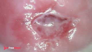Watch my Cervix while I Masturbate-7