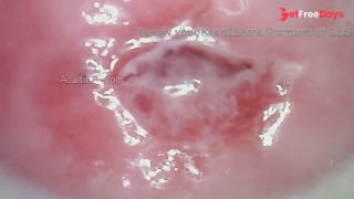 Watch my Cervix while I Masturbate-8