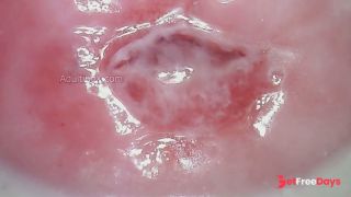 Watch my Cervix while I Masturbate-9