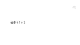 DASD-790 Observation 47 Days. A Former Idol Who Runs Away From Home With His Name Hidden. Nana Yaotome Nana -7