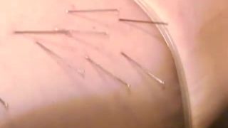 SNI-11 Nii Human Specimen No. 13, Its Pain Beauty Video S...-2