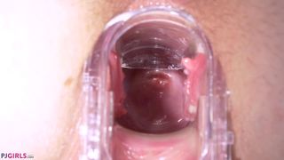 video 33 fetish webcam Gyno Car, cervix on anal porn-8